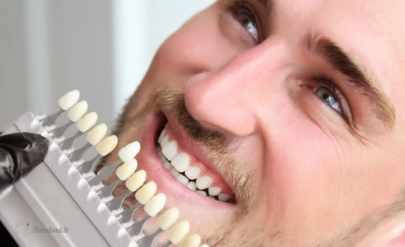 راه‌های سفیدی دندان؛ برای سفید شدن دندان چی خوبه؟