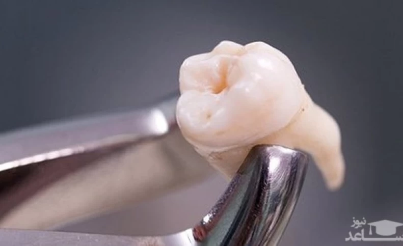 جویدن غذا چه اثری بر روی دندان ها می گذارد؟