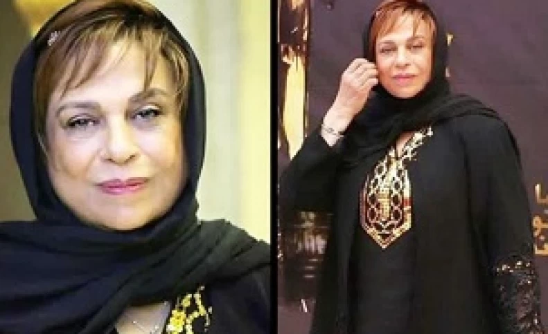 ناگفته های گوهر خیراندیش از تواضع ترانه علیدوستی تا عمل بینی