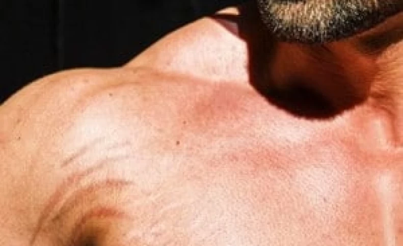 حالا که پوستت ترک خورده باید چیکار کنی؟