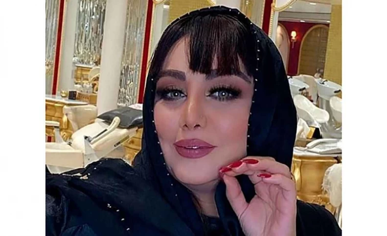 این خانم بازیگر رکورددار جراحی زیبایی ایرانی ! + تصاویری افشاگر !