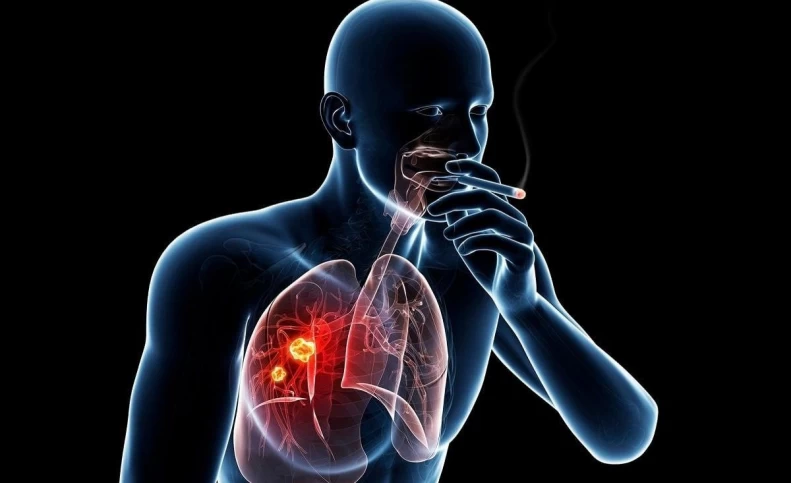 چرا سیگاری ها کمتر سرطان ریه می‌گیرند؟!