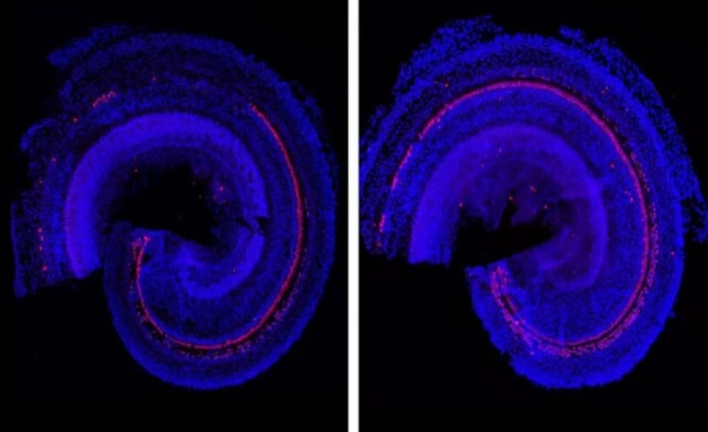 داروی جدید دانشمندان موسسه فناوری ماساچوست آمریکا برای کم‌شنوایی