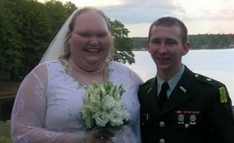 زشت‌ترین عروس دنیا چطور جذاب ترین شد + عکس های باورنکردنی