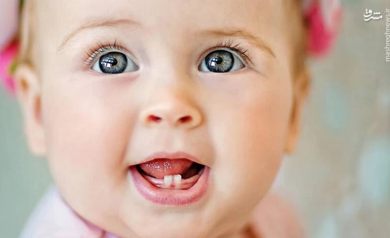 راه کاهش درد دندان درآوردن کودک بدون دارو در منزل