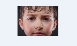 علت عرق کردن زیاد چیست؟/ بهترین روش برای درمان تعریق بیش از حد