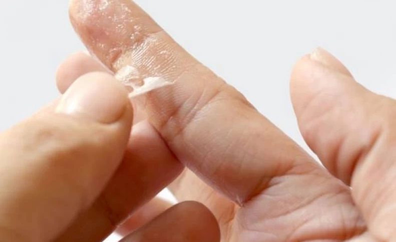 روش های فوری و آسان پاک کردن چسب قطره ای از روی دست