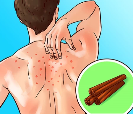 فواید دارویی دارچین گیاهان دارویی برای لاغری،گیاهان دارویی و خواص آنها