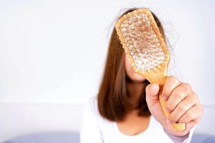 علت ریزش مو پاییزی ریزش مو شدید